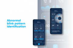 abnormal-blink-pattern-identification-1691593284-abnormal-blink-pattern-identification-clutch.png